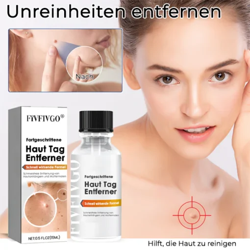 Fivfivgo® Advanced Skin Tag Remover - Fast Acting Formula