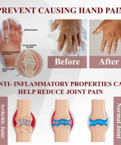 Fivfivgo™ Horse Chestnut Arthritis Massage Cream