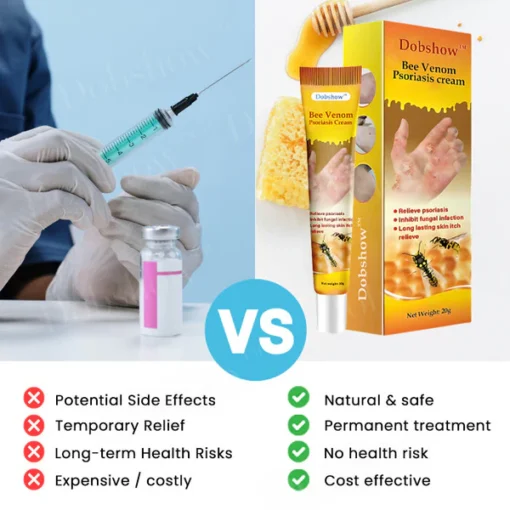 Dobshow™ Bee Venom Psoriasis Cream