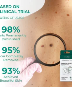 Oveallgo® Magnesium MicroPin Target & Clear Wart Removal Patch