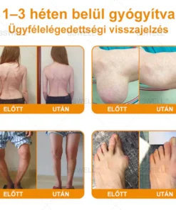 Lidocaine Pain Relief Roll-On Gel