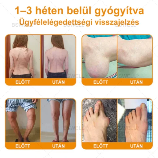 Lidocaine Pain Relief Roll-On Gel