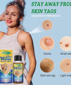 Herbal Acne Treatment Serum