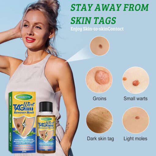 Herbal Acne Treatment Serum
