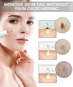 Fivfivgo™ Portable Laser Spot Cleaning Pen