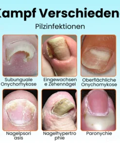 Cvreoz® Nail Strengthening Ointment