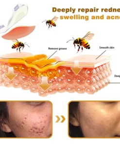 Furzero® Botox Bee Venom Pro MicroDarts Patch