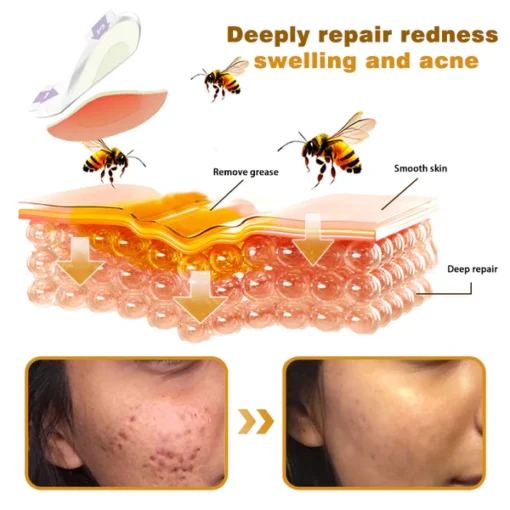 Furzero® Botox Bee Venom Pro MicroDarts Patch