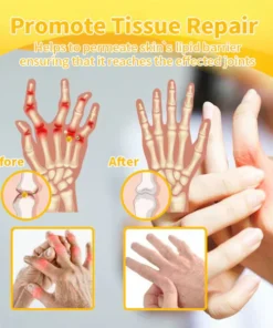 LOVILDS™ Bee poison Pain-Relief Bone Healing Cream