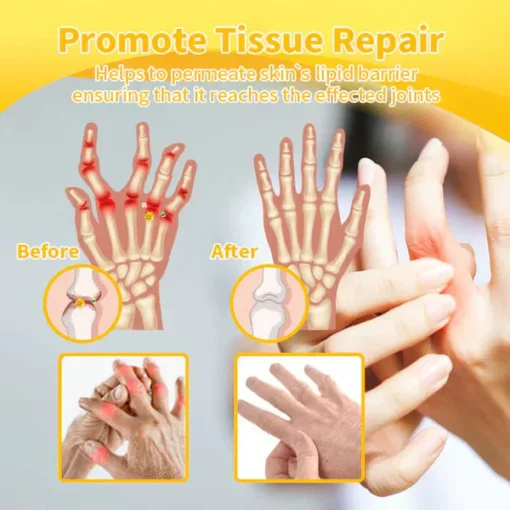 LOVILDS™ Bee poison Pain-Relief Bone Healing Cream
