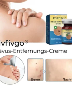 Fivfivgo® Nevus Removal Cream