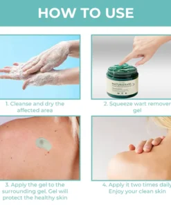 Oveallgo® NatureErase Gel zur sofortigen Entfernung von Muttermalen und Flecken