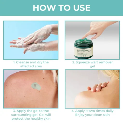 Oveallgo® NatureErase Gel zur sofortigen Entfernung von Muttermalen und Flecken