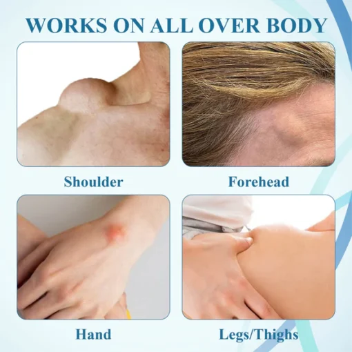 NEGUSY™ LumpsClear Lymph