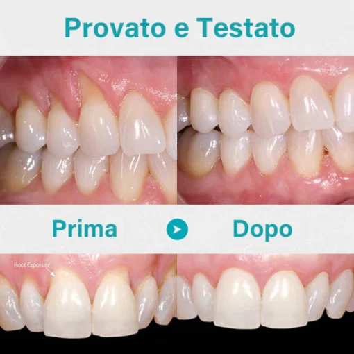 NESLEMY™ Gum Therapy Gel