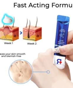 Fivfivgo® Freeze Zap Wart Gone Serum