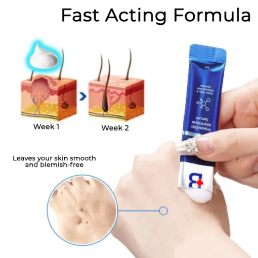 Fivfivgo® Freeze Zap Wart Gone Serum