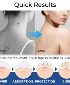 Fivfivgo® ClearTag Wart Removers: Seal & Heal Patches