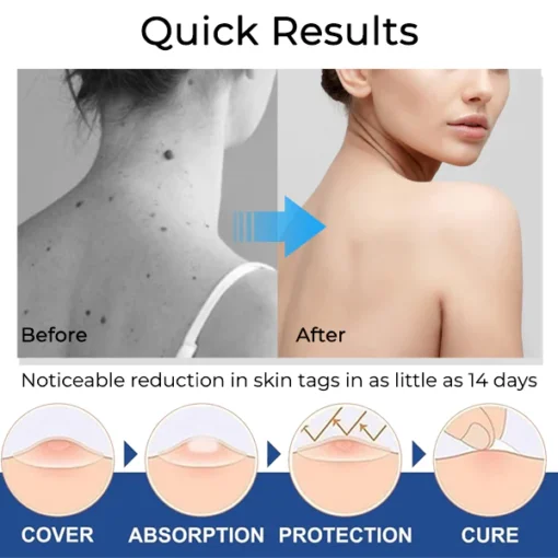Fivfivgo® ClearTag Wart Removers: Seal & Heal Patches