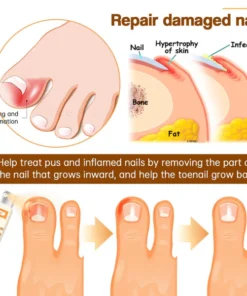 Cvreoz™ Bee Venom Nail Fungus Spray