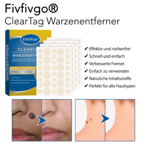 Fivfivgo® ClearTag Wart Remover: Seal & Heal Patches