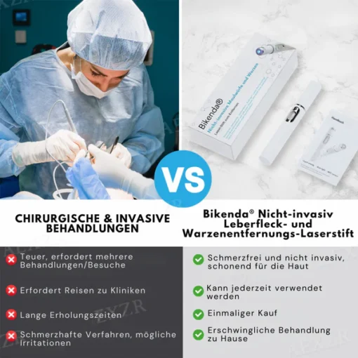 Bikenda® Nicht-invasiv Leberfleck- und Warzenentfernungs-Laserstift