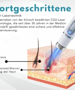 Bikenda® Nicht-invasiv Leberfleck- und Warzenentfernungs-Laserstift