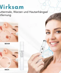 Bikenda® Nicht-invasiv Leberfleck- und Warzenentfernungs-Laserstift