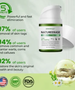 Official Store: Fivfivgo™ NatureErase Instant Mole & Spot Cream