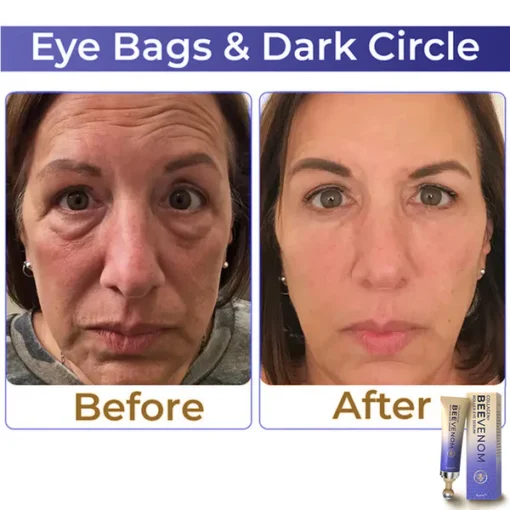 flysmus™ Collagen+ Bee Venom Roller Eye Cream