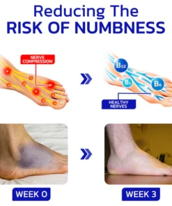 LOVILDS™ NumbFix Hands and Foots Spray