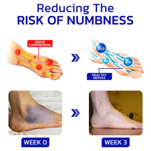 LOVILDS™ NumbFix Hands and Foots Spray
