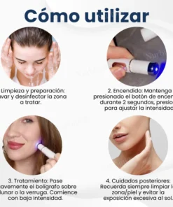 Nurbini® Non-Invasive Mole and Wart Removal Laser Pen