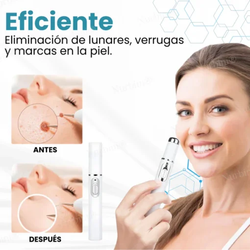 Nurbini® Non-Invasive Mole and Wart Removal Laser Pen