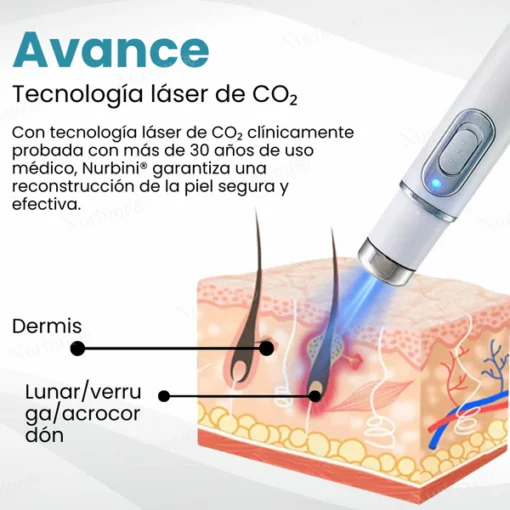 Nurbini® Non-Invasive Mole and Wart Removal Laser Pen