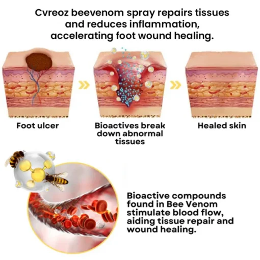 CVREOZ® Bee Venom Diabetic Foot Treatment Spray