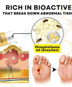 CVREOZ® Bee Venom Diabetic Foot Treatment Spray