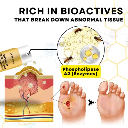 CVREOZ® Bee Venom Diabetic Foot Treatment Spray