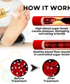 CVREOZ® Bee Venom Diabetic Foot Treatment Spray