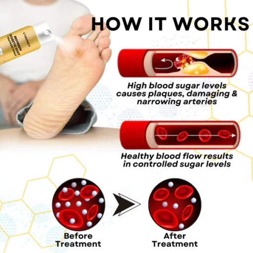 CVREOZ® Bee Venom Diabetic Foot Treatment Spray