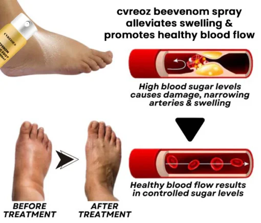 CVREOZ® Bee Venom Diabetic Foot Treatment Spray