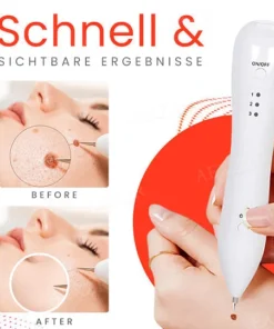 Fivfivgo™ Portable Skin Care Laser Pen
