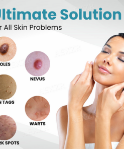 Bikenda® Non-Invasive Mole and Wart Removal Laser Pen