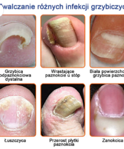 Furzero® Lifting & Firming – Instant Skin Tightener