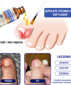 Furzero® Korean Ginseng Botox Wrinkle Removal Firming Serum