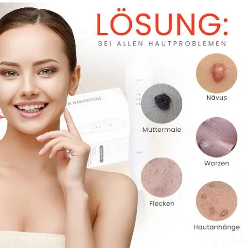 Fivfivgo™ Portable Skin Care Laser Pen