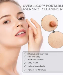 Fivfivgo™ Portable Laser Spot Cleaning Pen