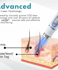 LAOZIK® Non-Invasive Mole and Wart Removal Laser Pen