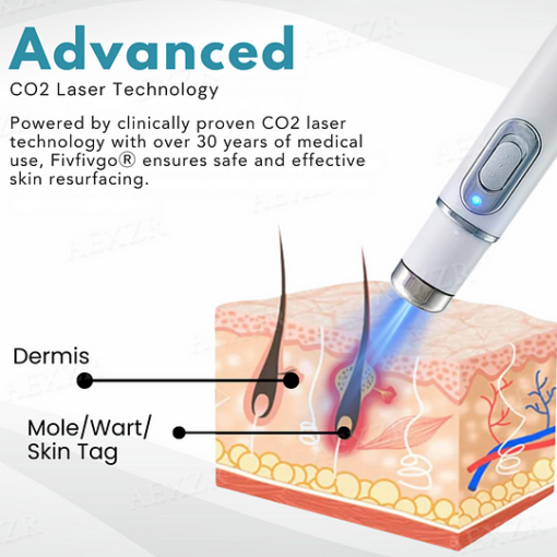 Bikenda® Non-Invasive Mole and Wart Removal Laser Pen