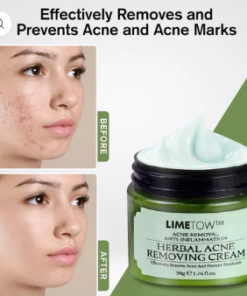 LIMETOW™ herbal acne removal cream